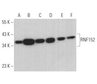RNF152 Antibody (F-6) - Western Blotting - Image 369455 