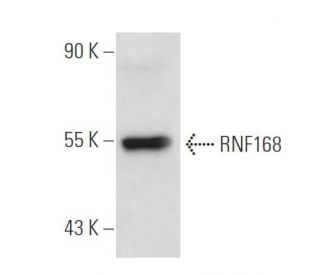 RNF168 Antibody (B-11) - Western Blotting - Image 32386Each CRISPR/Cas9 Knockout (KO) Plasmid product consists of a pool of 3 plasmids designed to ensure identification and cleavage of a specific gene for maximum knockout efficiency. Each plasmid encodes a unique 20 nt sequence derived from the GeCKO (v2) library.