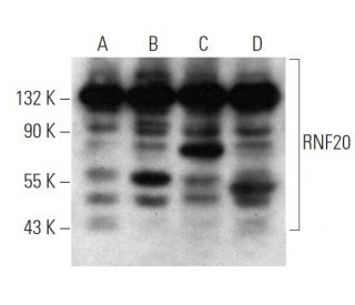 RNF20 Antibody (1594CT552.128.36) - Western Blotting - Image 374599