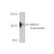 RNF213 Antibody (5C12) - Western Blotting - Image 350253