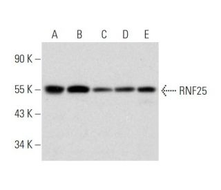RNF25 Antibody (C-12) - Western Blotting - Image 333603 