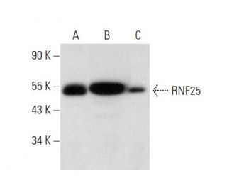 RNF25 Antibody (E-10) - Western Blotting - Image 308174 