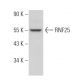 RNF25 Antibody (E-10) - Western Blotting - Image 371225