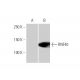 RNF40 Antibody (1C1) - Western Blotting - Image 347604 
