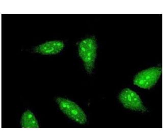 RNF6 Antibody (3B1) - Immunofluorescence - Image 351749 
