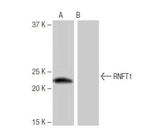 RNFT1 Antibody (10G3) - Western Blotting - Image 65046