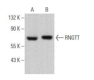 RNGTT Antibody (H-3) - Western Blotting - Image 368685 
