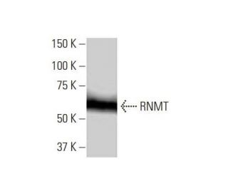 RNMT Antibody (3H3-1D12) - Western Blotting - Image 352167 