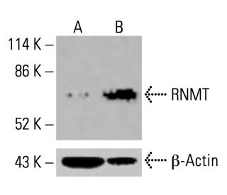 RNMT Antibody (3H3-1D12) - Western Blotting - Image 416134 