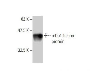 western blotting image from recommended robo1 (2G6) monoclonal antibody replacement. Image 348581
