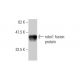 western blotting image from recommended robo1 (2G6) monoclonal antibody replacement. Image 348581
