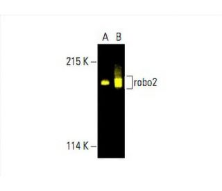 robo2 Antibody (A-10) - Western Blotting - Image 392771Each CRISPR/Cas9 Knockout (KO) Plasmid product consists of a pool of 3 plasmids designed to ensure identification and cleavage of a specific gene for maximum knockout efficiency. Each plasmid encodes a unique 20 nt sequence derived from the GeCKO (v2) library. 