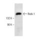 Rock-1 Antibody (H-11) - Western Blotting - Image 143401