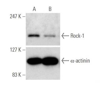 Rock-1 siRNA (h): sc-29473. Western blot analysis of Rock-1 expression in non-transfected control (A) and Rock-1 siRNA tra 