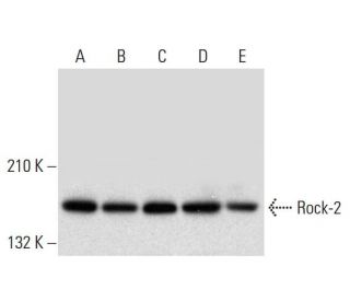 western blotting image from recommended Rock-2 (D-11) monoclonal antibody replacement. Image 305692
