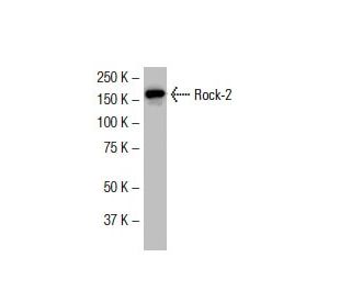 Rock-2 Antibody (30-J) - Western Blotting - Image 33798
