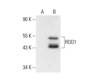 ROD1 Antibody (C-1) - Western Blotting - Image 301377