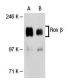 Ron β Antibody (A-8) - Western Blotting - Image 30308 