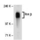 Ron β Antibody (A-8) - Western Blotting - Image 30312