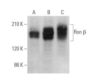 Ron &beta; Antibody (A-8) - Western Blotting - Image 375114 