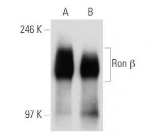 western blotting image from recommended Ron β (E-3) monoclonal antibody replacement. Image 30311