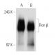Este anticorpo policlonal foi descontinuado. Consulta o nosso anticorpo monoclonal <a href="ron-beta-antibody-e-3">Ron β (E-3)</a> recomendado (dados de amostra apresentados). western blotting image from recommended Ron β (E-3) monoclonal antibody replacement. Image 30311