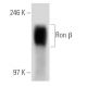 Ron β Antibody (E-3) - Western Blotting - Image 30310 