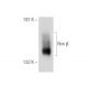Ron β Antibody (E-9) - Western Blotting - Image 153900