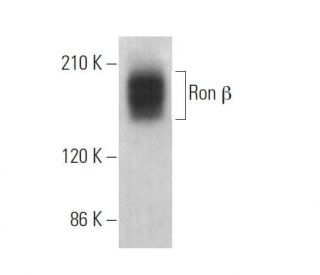 Ron &beta; Antibody (E-9) - Western Blotting - Image 375117 