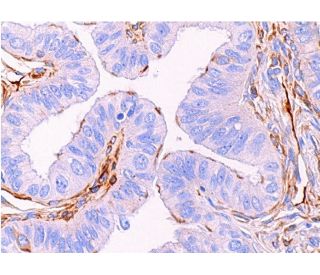 Rootletin Antibody (C-2) - Immunohistochemistry - Image 373639 