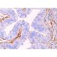 This polyclonal antibody has been discontinued. See our recommended <a href="rootletin-antibody-c-2">Rootletin (C-2)</a> monoclonal antibody (sample data shown). immunohistochemistry image from recommended Rootletin (C-2) monoclonal antibody replacement. Image 373639