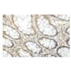 ROPN1 Antibody (IW.63) - Immunohistochemistry - Image 53955