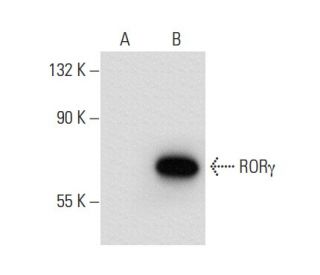 RORγ Antibody (162C2a) - Western Blotting - Image 68021