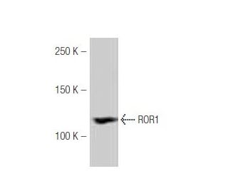 ROR1 Antibody (60-D) - Western Blotting - Image 53877