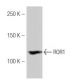 ROR1 Antibody (60-D) - Western Blotting - Image 53877