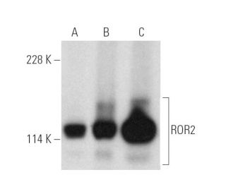 ROR2 Antibody (H-1): sc-374174