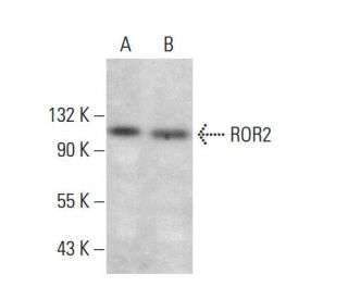 ROR2 Antibody (H-1) - Western Blotting - Image 381339