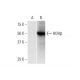 RORβ Antibody (4B4) - Western Blotting - Image 352135 