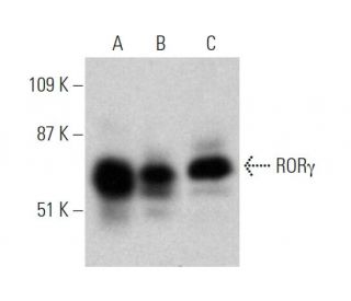 ROR&gamma; Antibody (27.92) - Western Blotting - Image 370521 