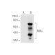 western blotting image from recommended RORγ (D-4) monoclonal antibody replacement. Image 141553