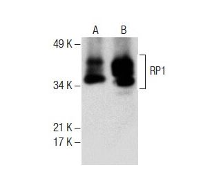 RP1 Antibody (F-11) - Western Blotting - Image 287872 