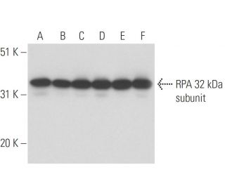 RPA 32 kDa subunit Antibody (MA34) - Western Blotting - Image 12580