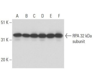 RPA 32 kDa subunit Antibody (MA34) - Western Blotting - Image 17177