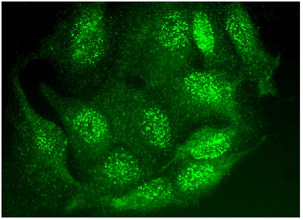 RPA 70 kDa subunit Antibody (B-10) | SCBT - Santa Cruz