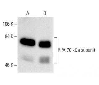 RPA 70 kDa subunit Antibody (B-6) | SCBT - Santa Cruz Biotechnology