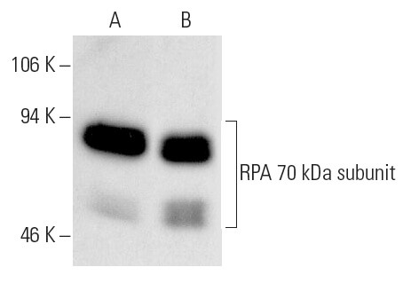 rpa-70-kda-subunit-antibody-b-