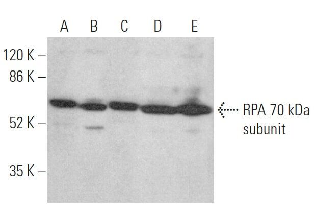rpa-70-kda-subunit-antibody-b-