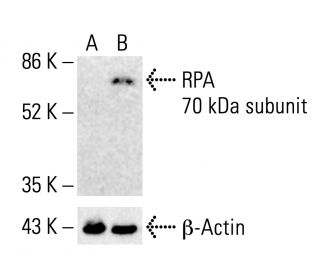 RPA 70 kDa subunit Antibody (B-6) | SCBT - Santa Cruz Biotechnology