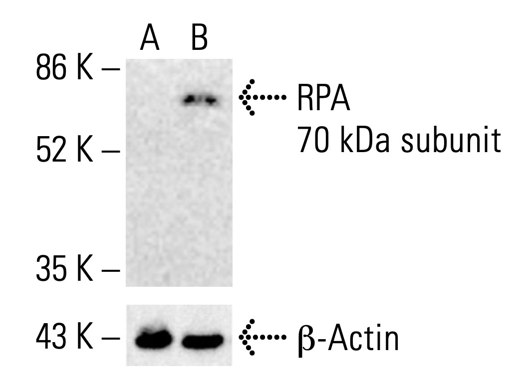 RPA 70 kDa subunit Antibody (B-6) | SCBT - Santa Cruz
