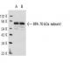 RPA 70 kDa subunit Antibody (MA70-2) - Western Blotting - Image 12570